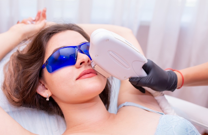 Hair Removal Laser